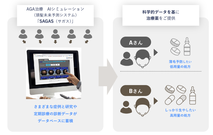 Dクリニック　AGA治療　AIシミュレーションSAGAS（サガス）